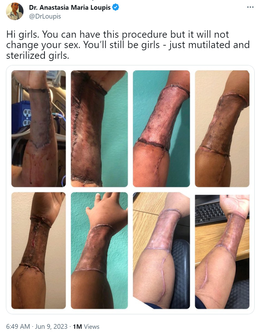 girl arm skind penis 2023-06-09