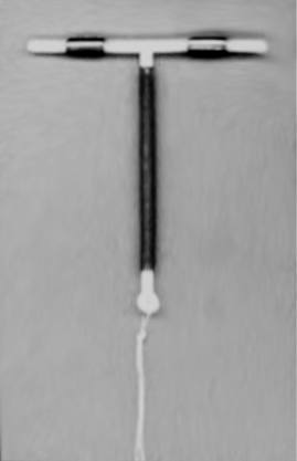 IUD CP Copper T380A