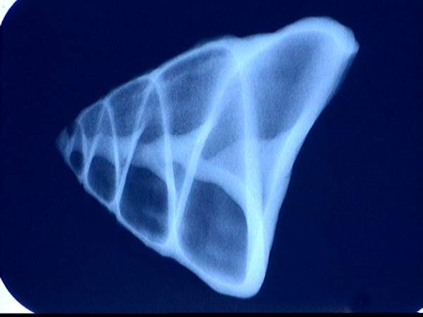 seashell x-ray