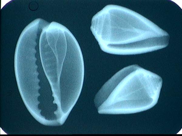 seashell x-ray